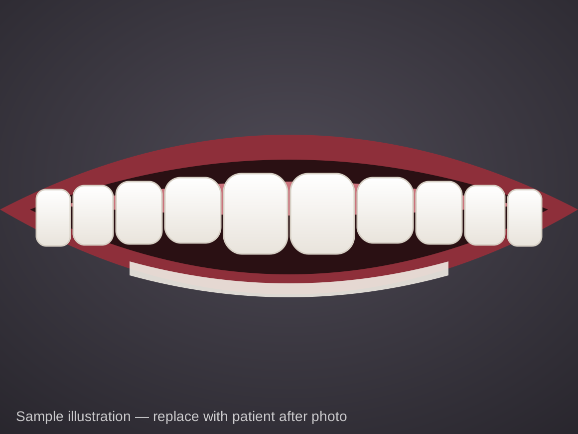 After (sample illustration): Braces, age 13